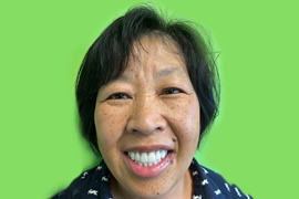 Case 102 - Real patient dental results of Peninsula Dental Implant Center