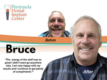 Bruce Before & After Image