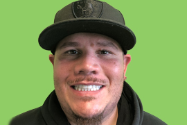 Derrek - Real patient dental results of Peninsula Dental Implant Center