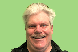 Before & After happy Patient male Fred Smile at Peninsula Dental Implant Center San Carlos