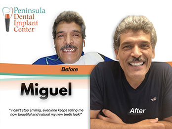 Miguel Before & After Image