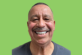 Mike V - Real patient dental results of Peninsula Dental Implant Center