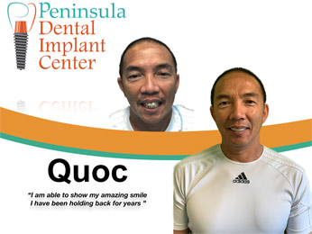 Quoc Before & After Image