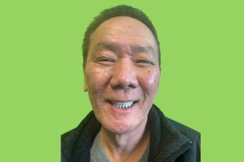 Case 105 - Real patient dental results of Peninsula Dental Implant Center