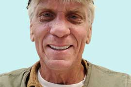 Smile Tranformation 14