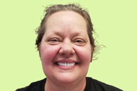 Smile Tranformation 20