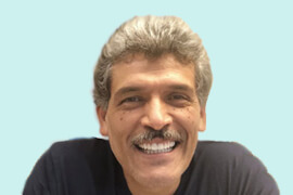 Smile Tranformation 02