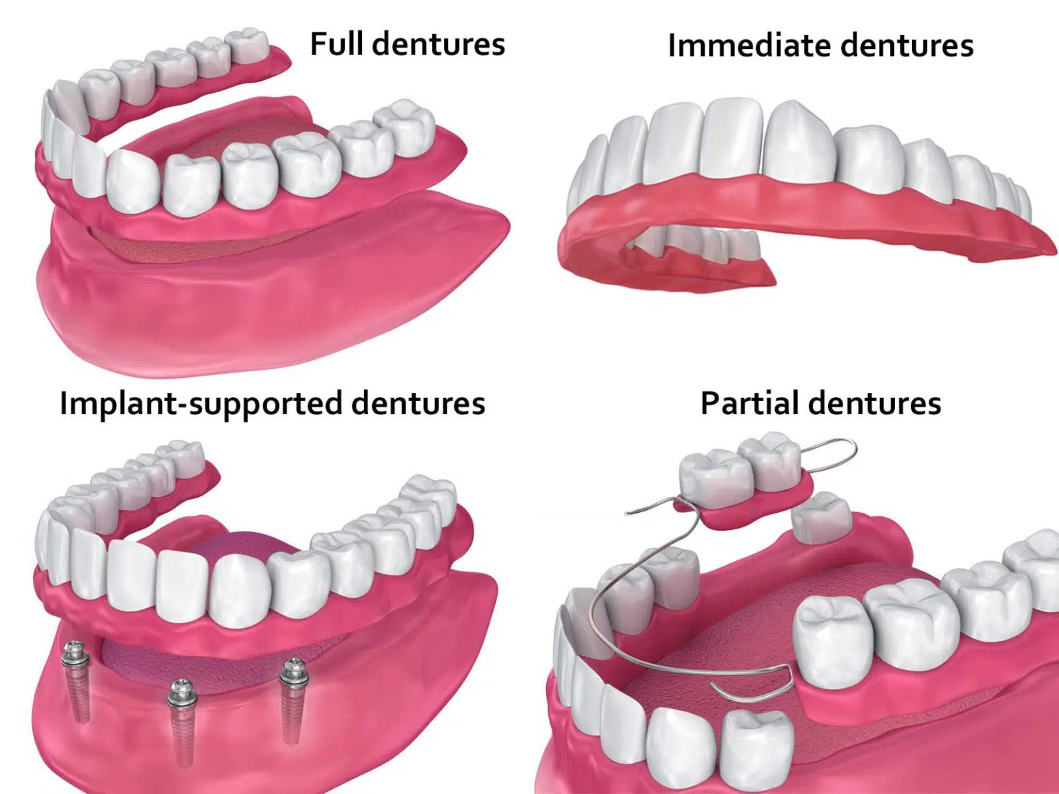 Learn More About Dentures Treatment