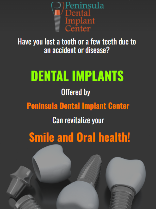 Dental implants offered by Peninsula Dental Implant Center