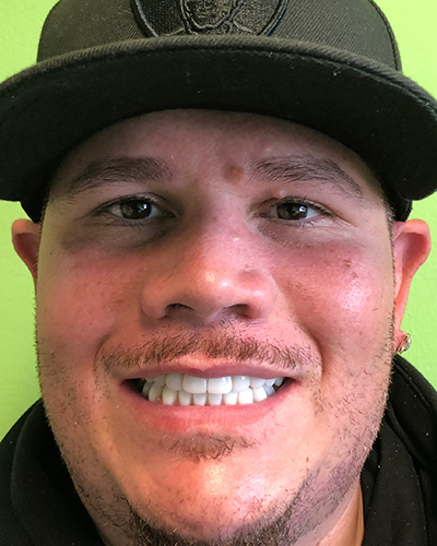 Derrek Gones - Before & After Results, After Image