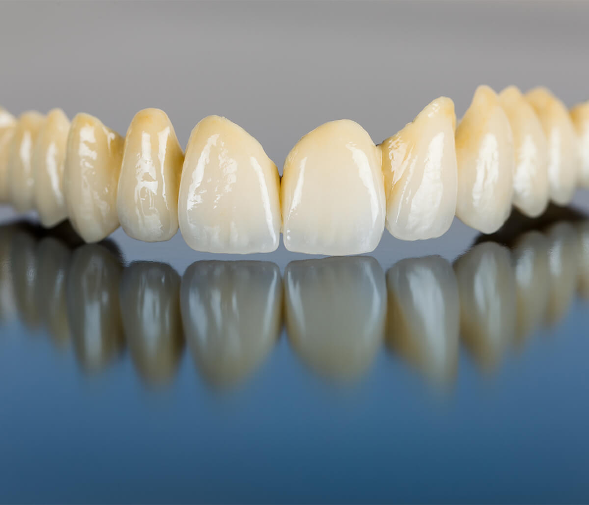 Implant Supported Dentures in Palo Alto CA Area