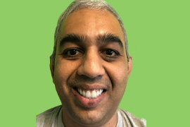 Rajesh R. - Real patient dental results of Peninsula Dental Implant Center