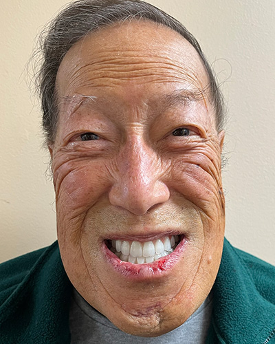 Derrek Gones - Before and After Results, After Image