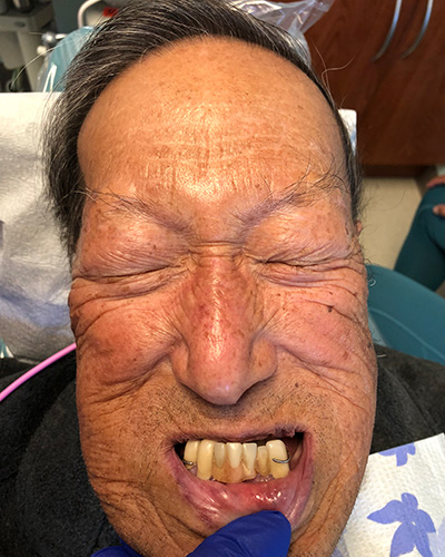 Richard Mark - Before and After Results, Before Image-2