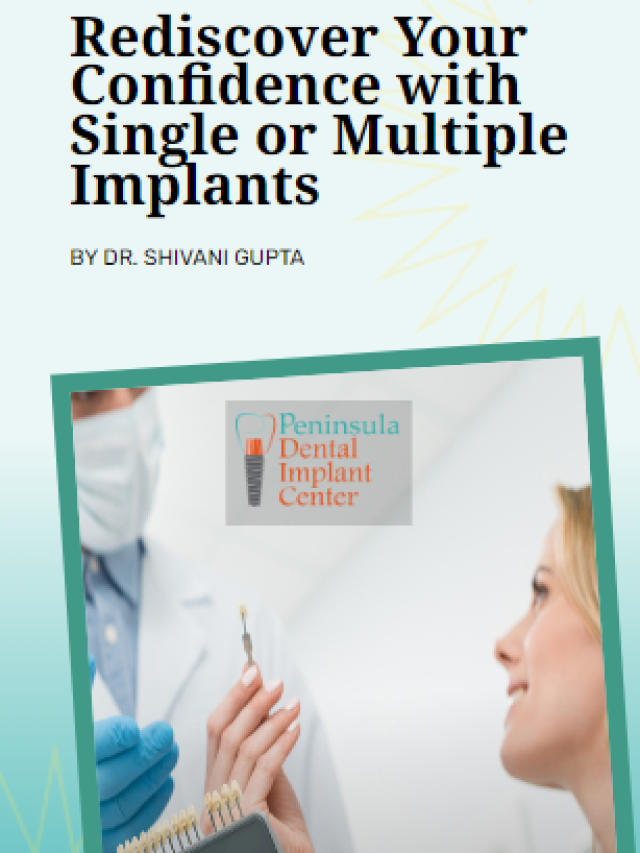 Rediscover Your Confidence with Single or Multiple Implants 