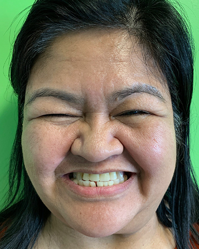 Juliet - Before and After Results, Before Image