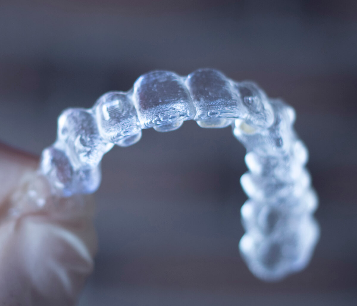 Can I Get Invisalign With Implant in San Carlos CA Area
