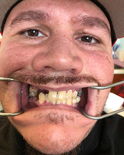 derrek-gones-before-1