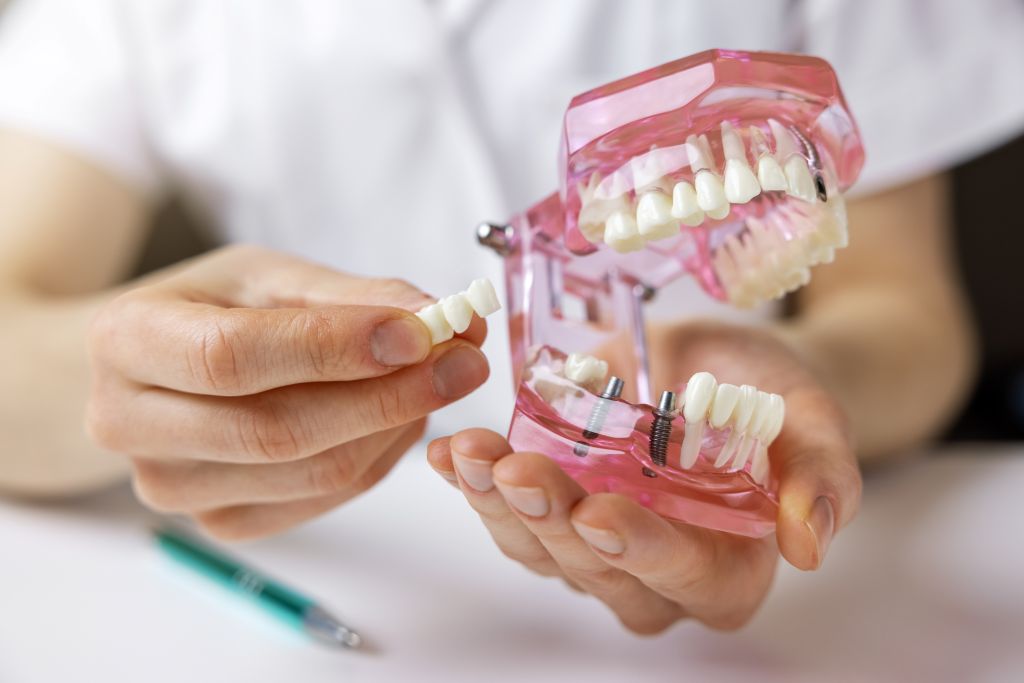 single or multiple dental implant treatments near you