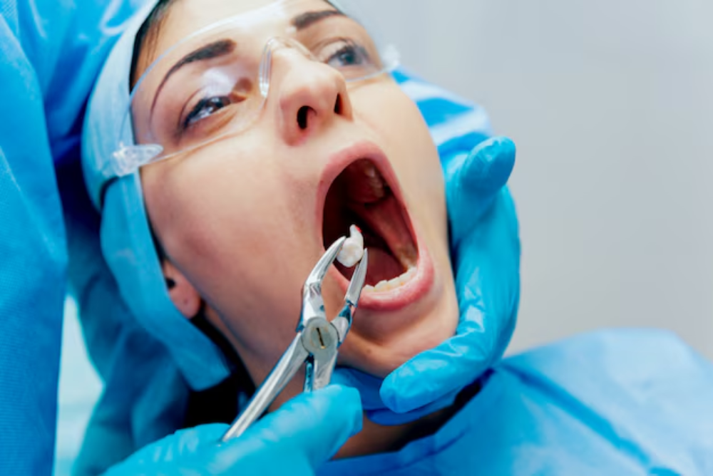 Looking for a tooth extraction in Redwood City? If you’re searching for tooth extraction near me, we offer gentle, reliable dental care. Book your visit now!