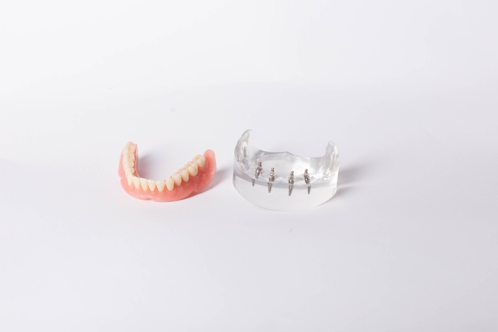 can you eat anything with all on four implants